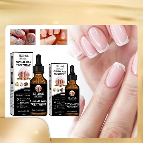 NailFix Pro™ Repair Serum – 2PC